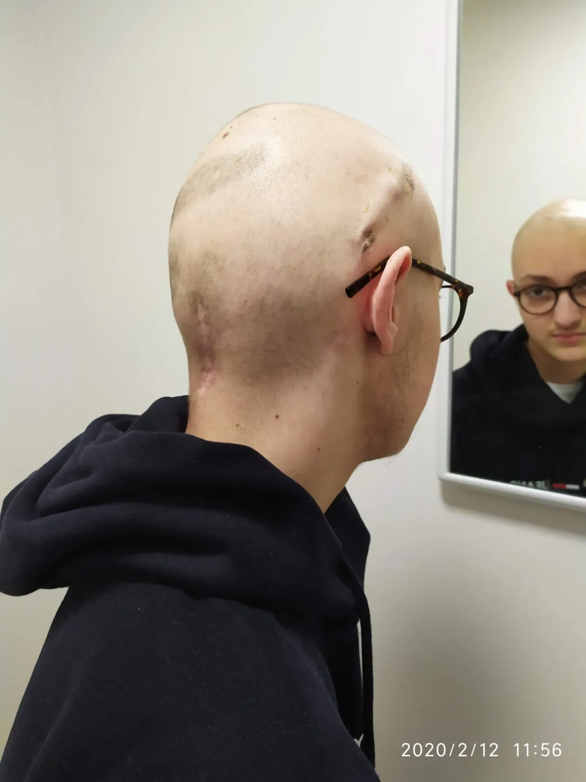 Eugenio guarda la sua testa calva