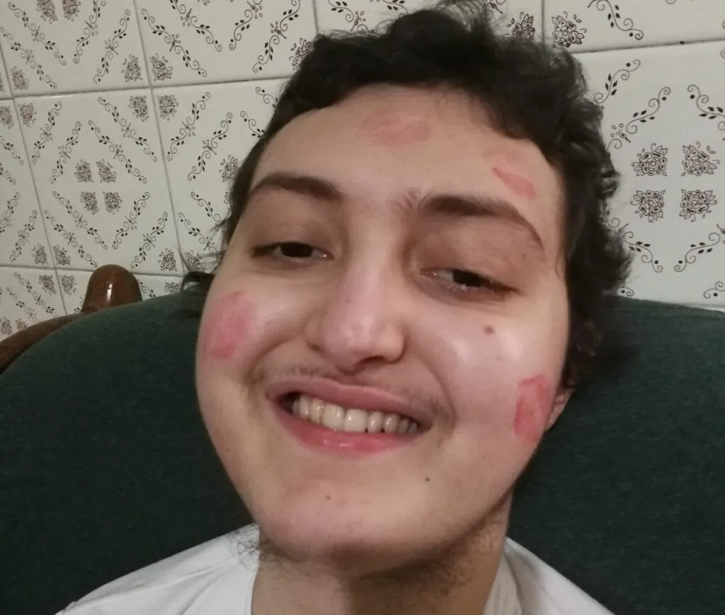 primo piano Eugenio con bacioni