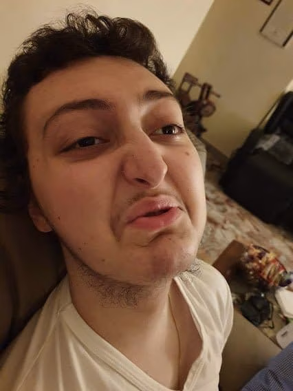 Eugenio smorfia per le caramelle