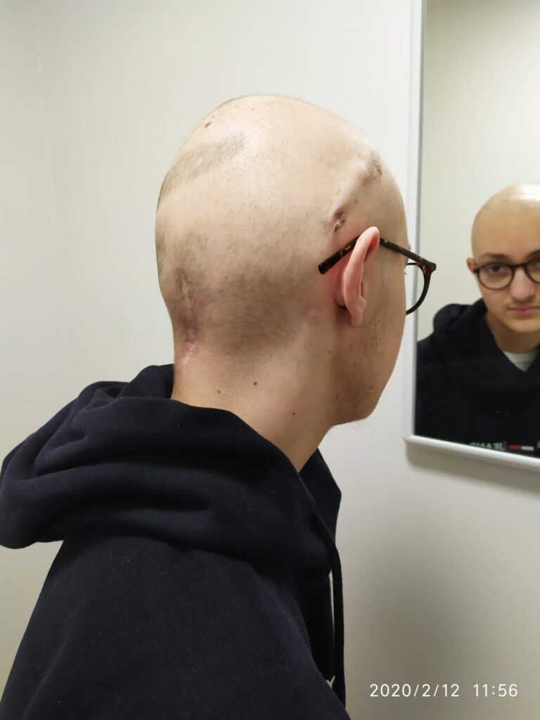 Eugenio guarda la sua testa calva