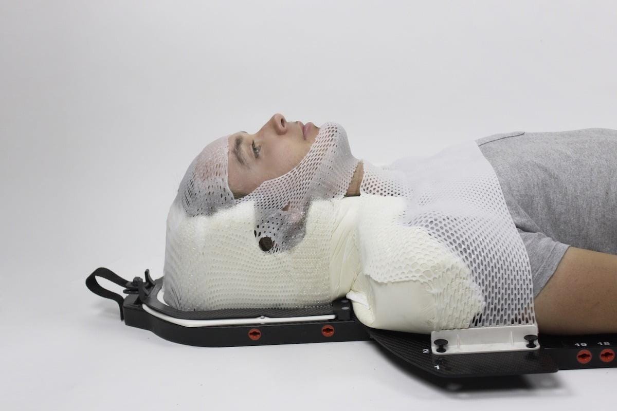 maschera radioterapia: fibrillazione